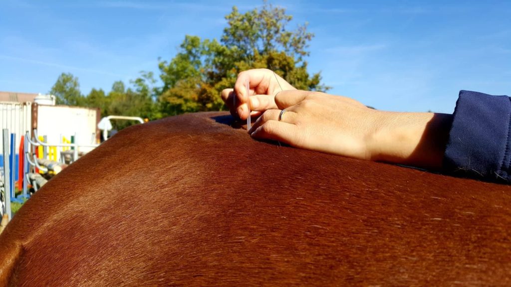 dry needling